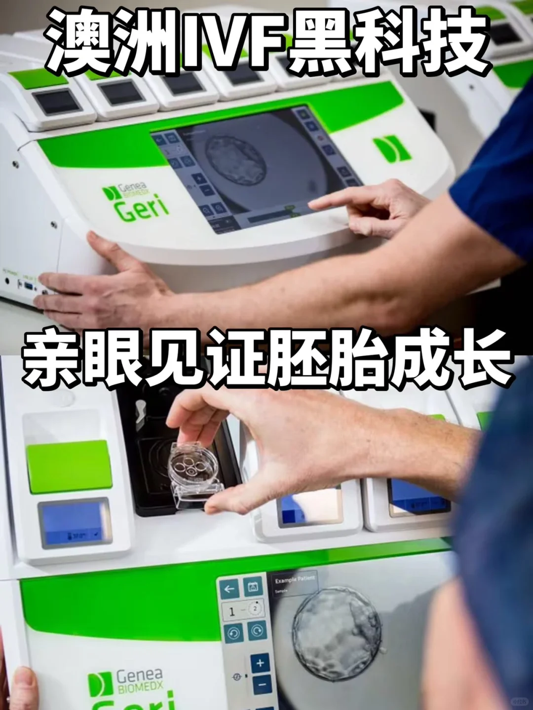 澳洲黑科技！Geri培养箱实时见证胚胎成长！,供卵助孕服务机构